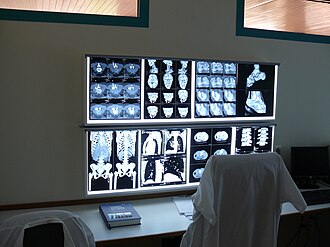 خدمة الأشعة والتحاليل في المنزل 1: رعاية طبية متكاملة بخطوات سهلة